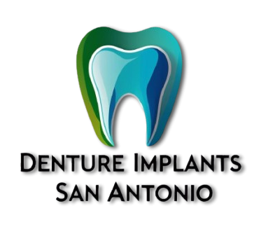 denture implants San Antonio TX