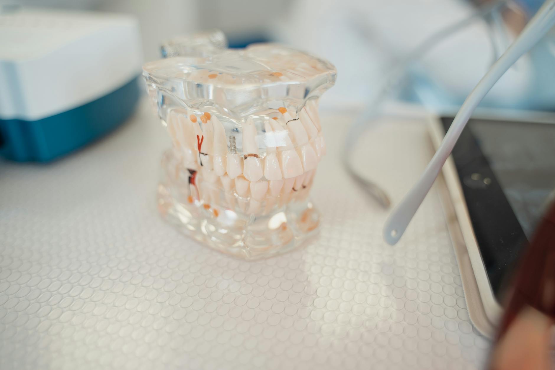 dental implants strategies and examples