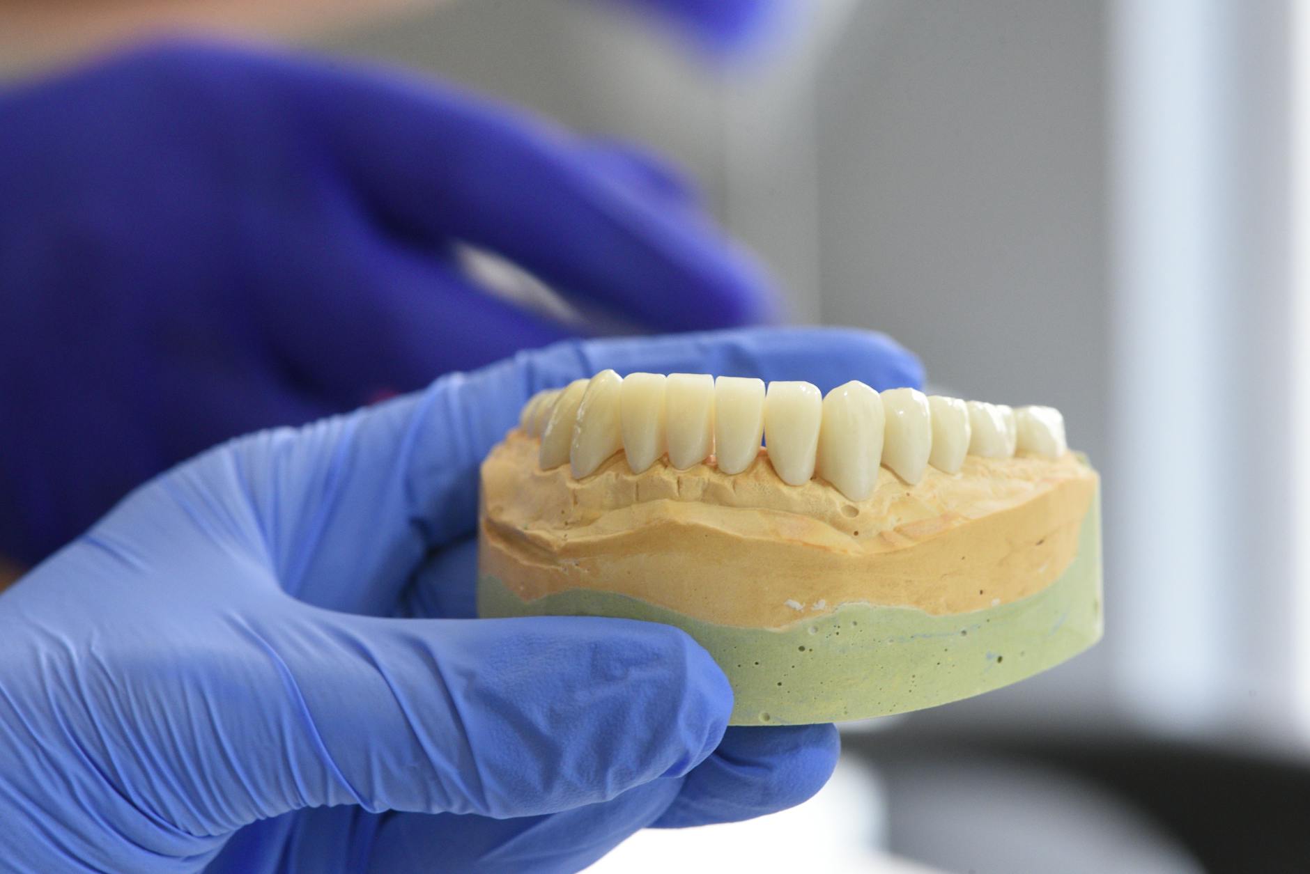 robotic assisted dental implant surgery benefits overview and key insights